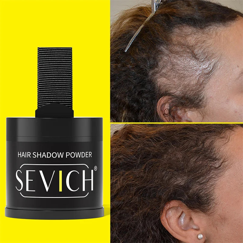 Sevich Hairline Powder – Instant Hair Filler for Thinning Areas & Root Touch-Up